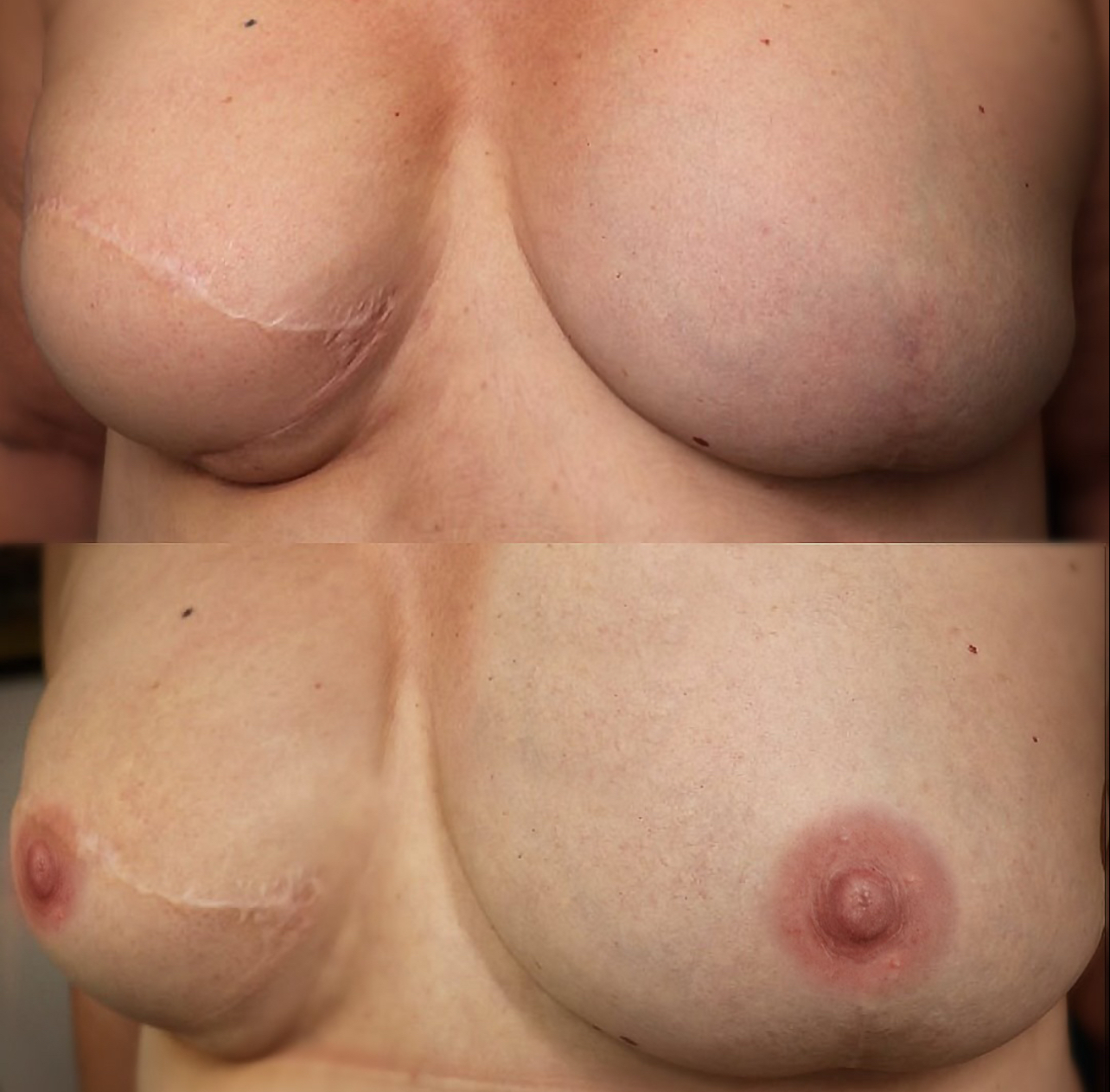 Paramedical Art Areola & Skin - Luisa Sánchez