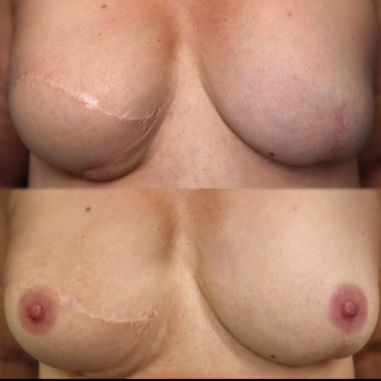 Paramedical Art Areola & Skin - Luisa Sánchez