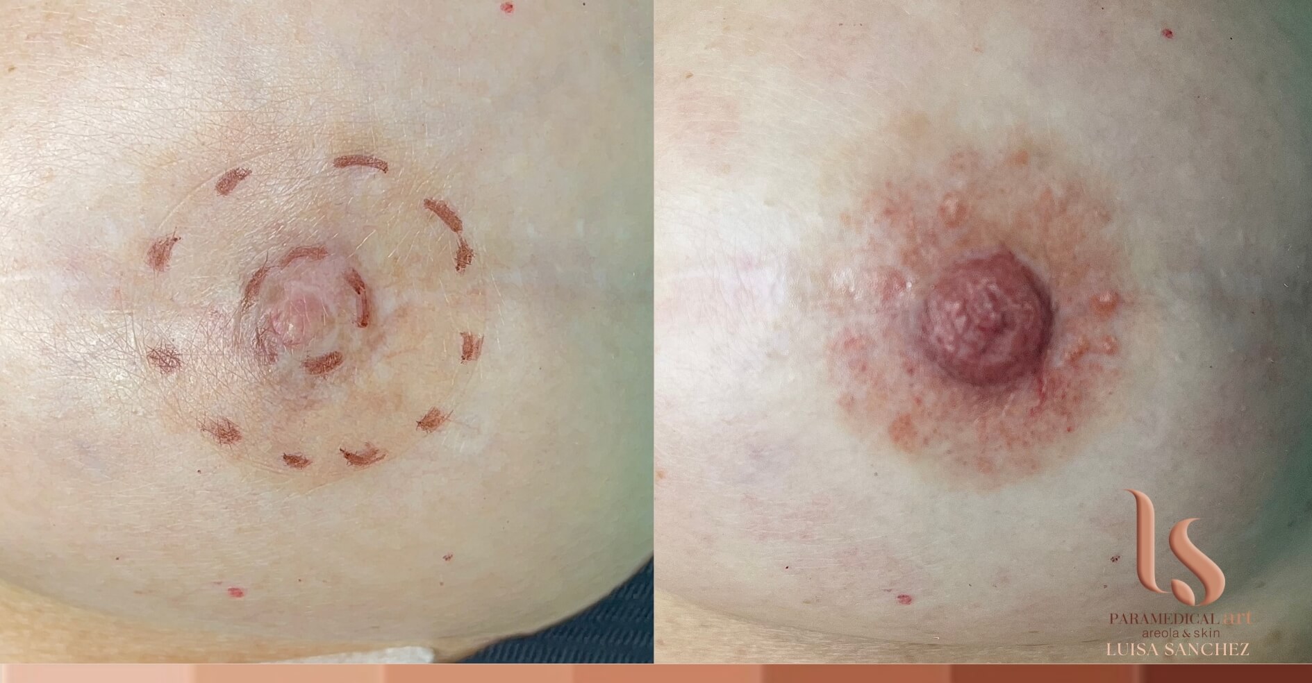 Paramedical Art Areola & Skin - Luisa Sánchez