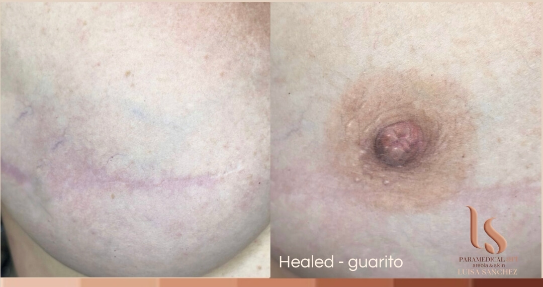Paramedical Art Areola & Skin - Luisa Sánchez