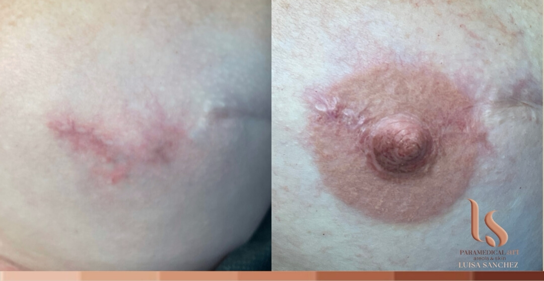 Paramedical Art Areola & Skin - Luisa Sánchez