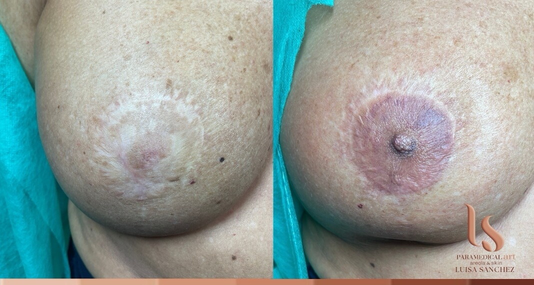 Paramedical Art Areola & Skin - Luisa Sánchez