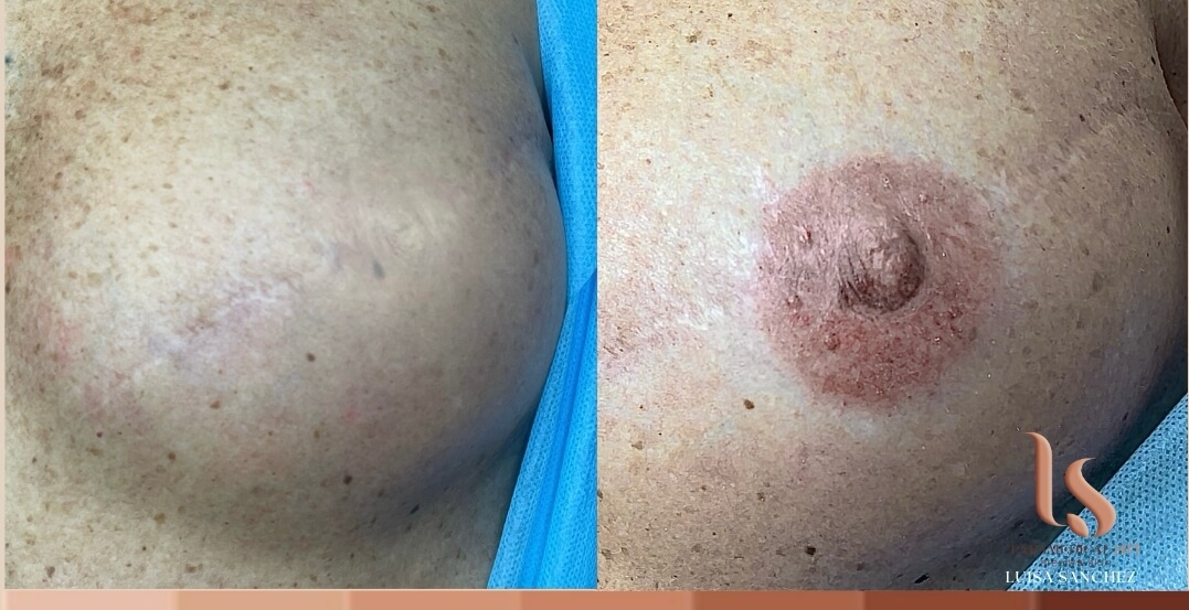 Paramedical Art Areola & Skin - Luisa Sánchez